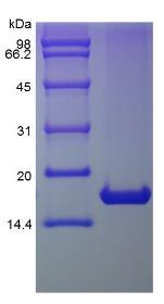 SDS-PAGE (IL1RN-05H).jpg